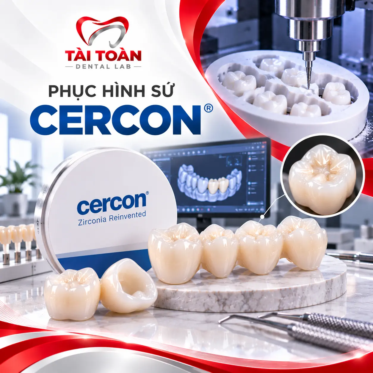 PHỤC HÌNH SỨ CERCON