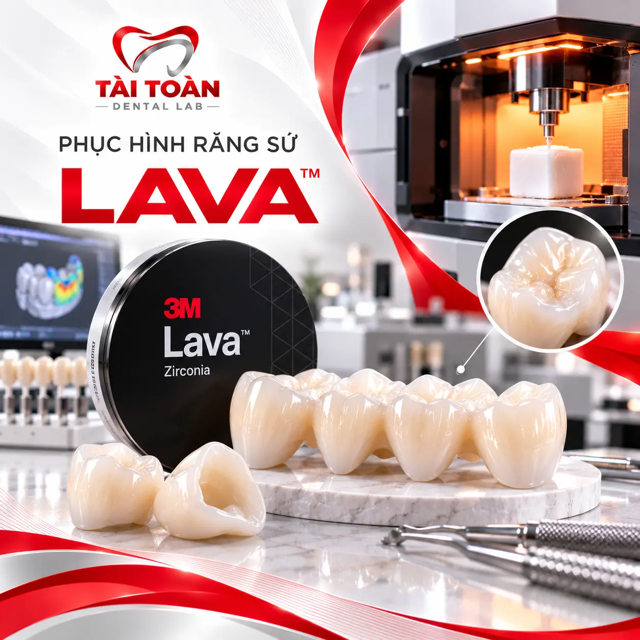 PHỤC HÌNH RĂNG SỨ LAVA