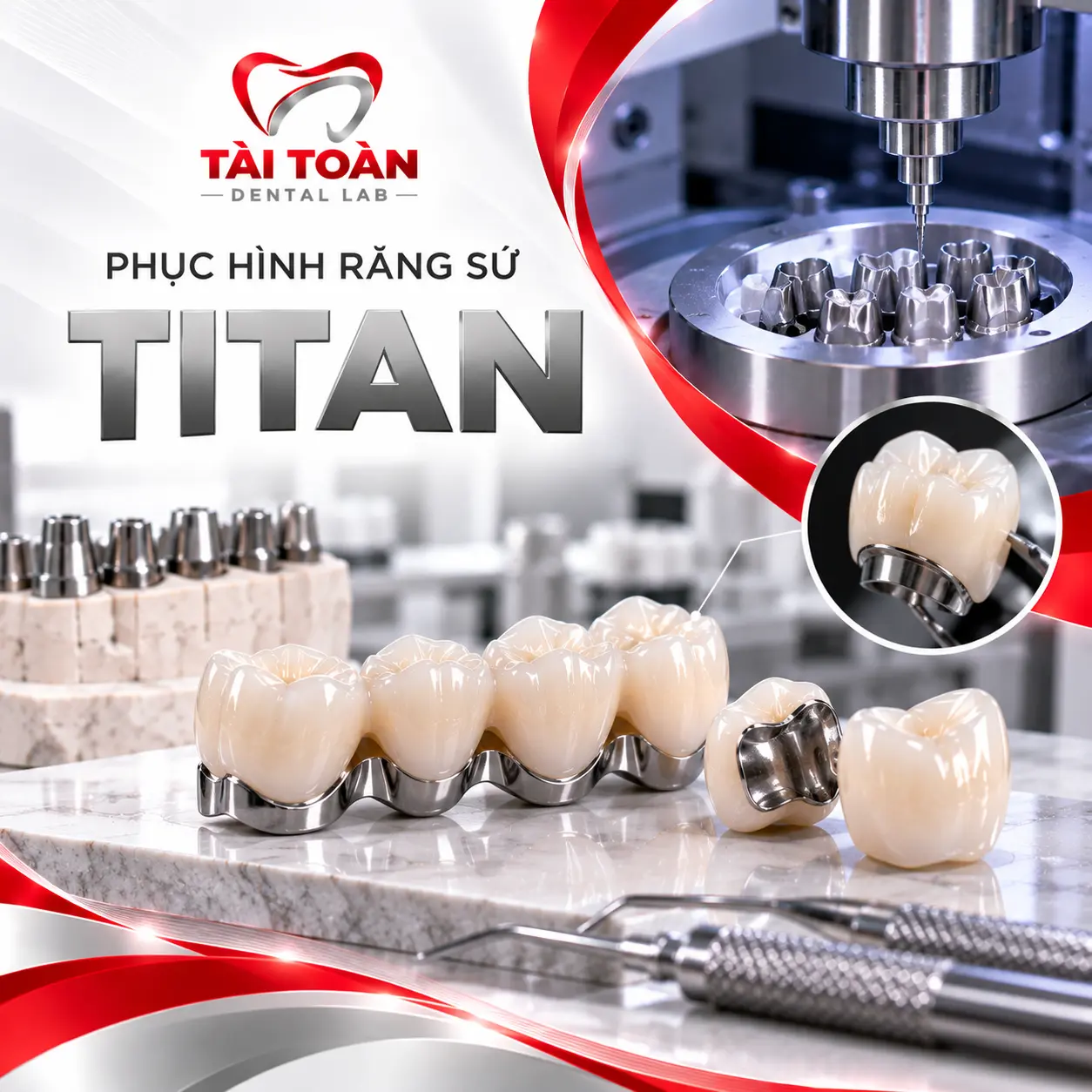 PHỤC HÌNH RĂNG SỨ TITAN